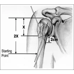 Article figure