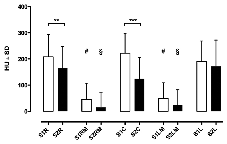 Comparison of S1 and S2 density at five regions of interests of the posterior pelvic ring. ***P < 0.001, **P < 0.01, #P < 0.001 versus S1R, S1C, and S1 L.§P < 0.001 versus S2R, S2C, and S2L. Data shown are mean HU values ± standard deviation. White for level S1, black for level S2. HU = Hounsfield unit