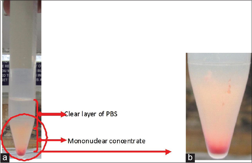 (a) Buffy colored concentrate of mononuclear fraction after washing (twice) with PBS and (b) a magnified view. PBS = Phosphate-buffered saline