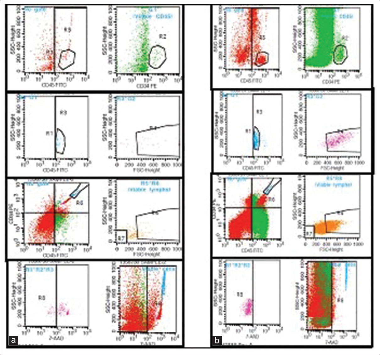 Flow cytometric analysis of aspirate (a) and concentrate (b); showing significant concentration of mononuclear fraction (CD34, CD45, and lymphs)