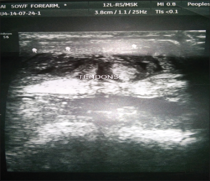 Ultrasonography