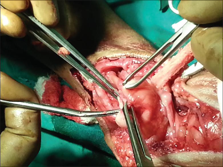 Intraoperative photo