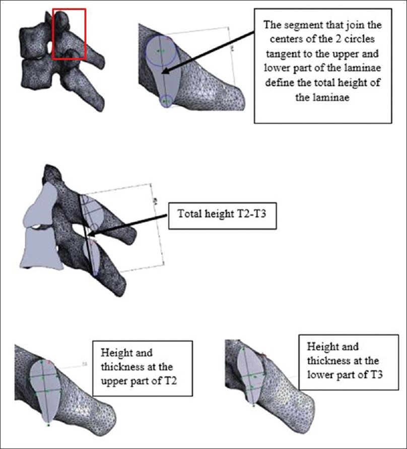 Height and thickness at different levels in T2 and T3