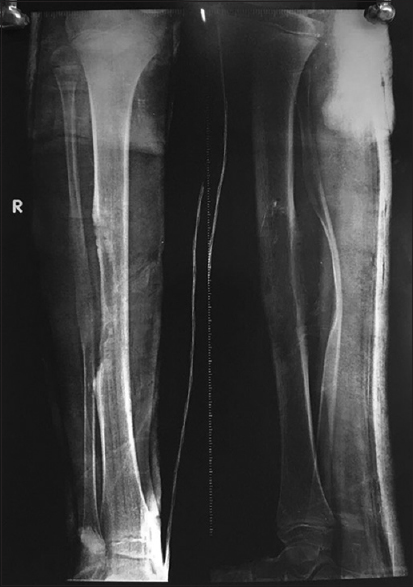 Postoperative X-ray