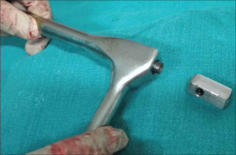 The part of proximal jig for femoral nail broken soon after mounting the nail. The another jig arrangement delayed the surgery