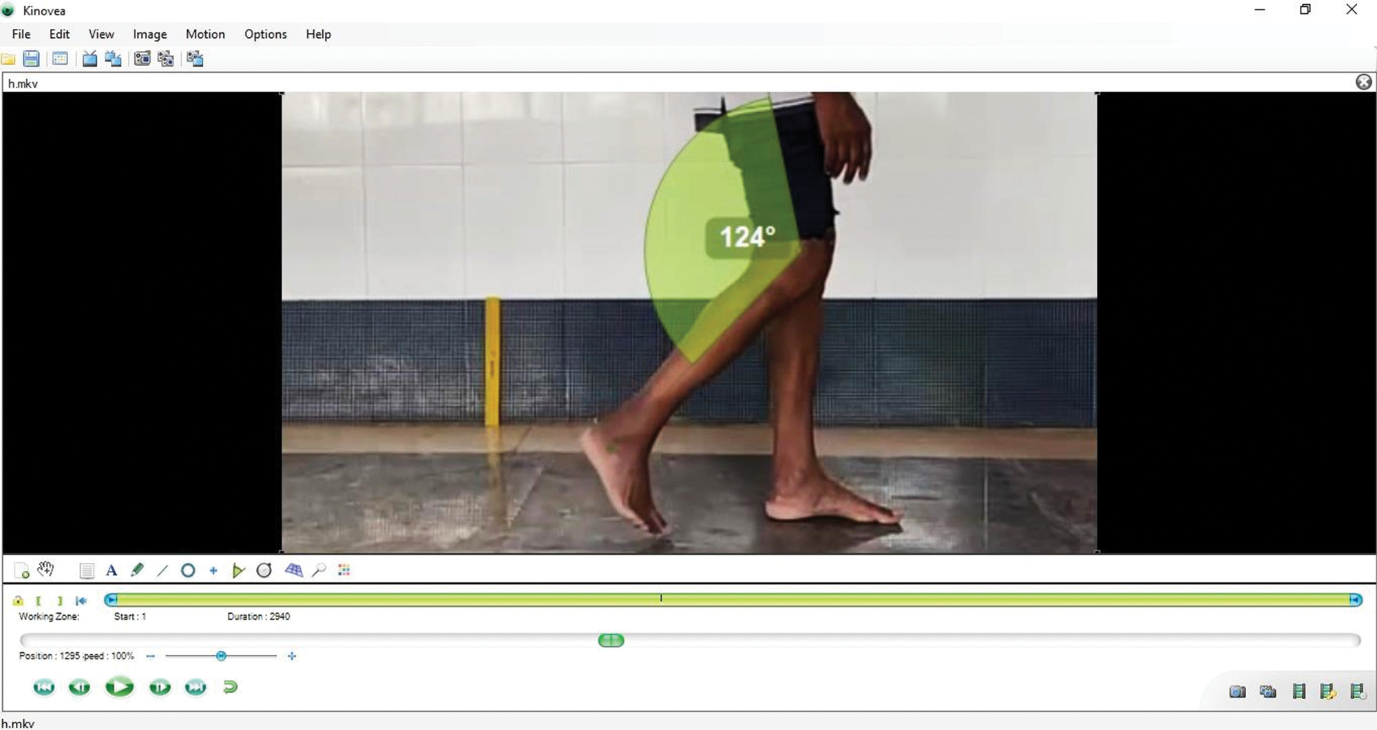 A process for measuring knee goniometry using Kinovea software (reproduction size at column width)