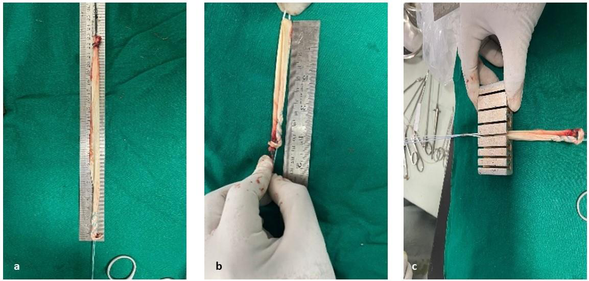 (a) Graft with a length of 24.77 cm. (b) Doubled graft with a length of 12.38 cm. (c) Graft with a thickness of 9 mm.