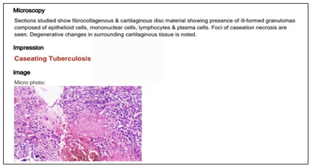 Microbiological reports of biopsy sample.